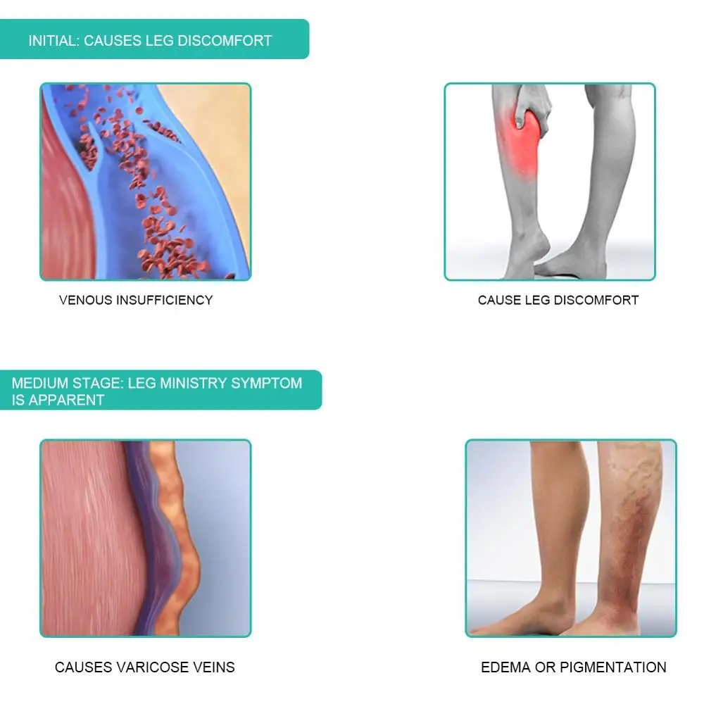 1 paio di calzini a compressio - Compression Sock Medical recensione e prezzo