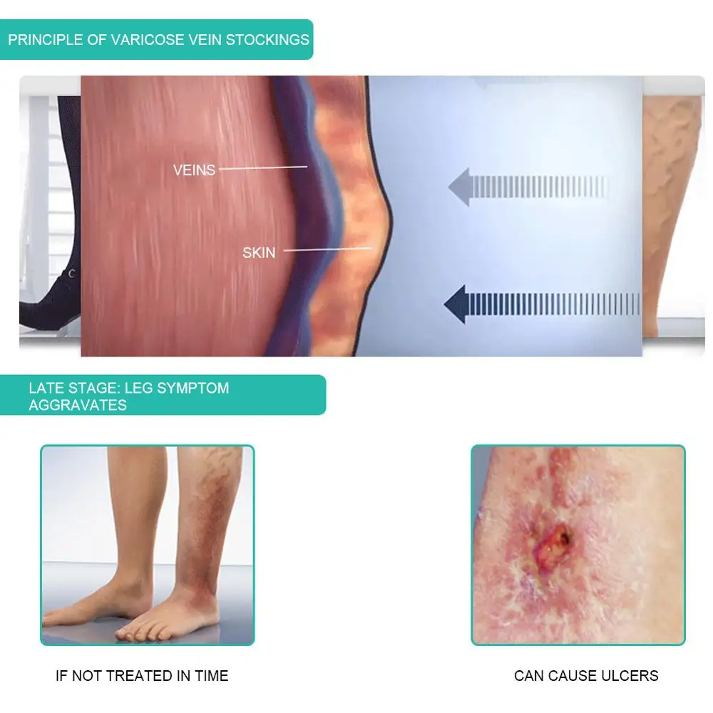 1 paio di calzini a compressio - Compression Sock Medical recensione e prezzo